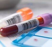 Prostatitisaren laborategiko diagnostikoa