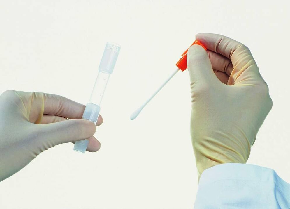 Azterketa-bilketa prostatitis kronikoa detektatzeko