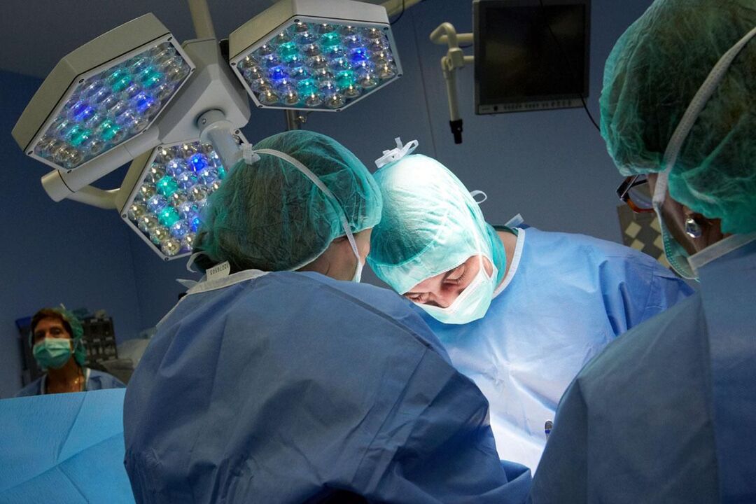 Prostatitis kronikoan eragiketa