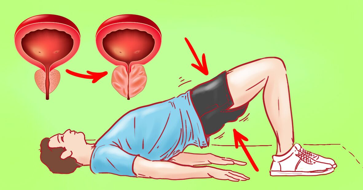 Prostatitis kronikorako ariketa terapeutikoak